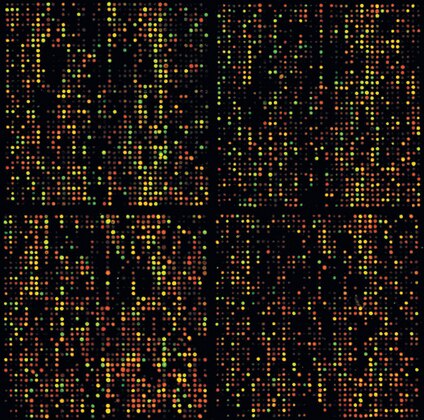 Enlarged section of a 19,299 element microarray (image reproduced with permission from Dr. John Quakenbush, The Institute for Genomic Research). High quality microarrays can be manufactured using PCR products purified with MultiScreen PCR products. Reference: Hegde, P., R. Qi, K. Abernathy, C. Gay, S. Dhaarp, R. Gaspard, J.E. Hughes, E. Snesrud, N. Lee and J. Quakenbush. 2000. A concise guide to cDNA microarray analysis. BioTechniques 29: 548–562.